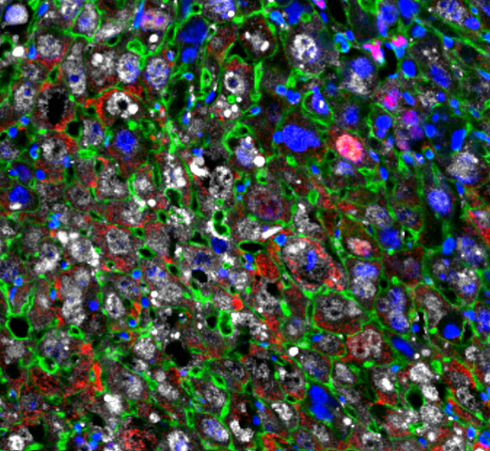 ترمیم سریع بافت آسیب دیده کبد توسط بازسازی سلولی